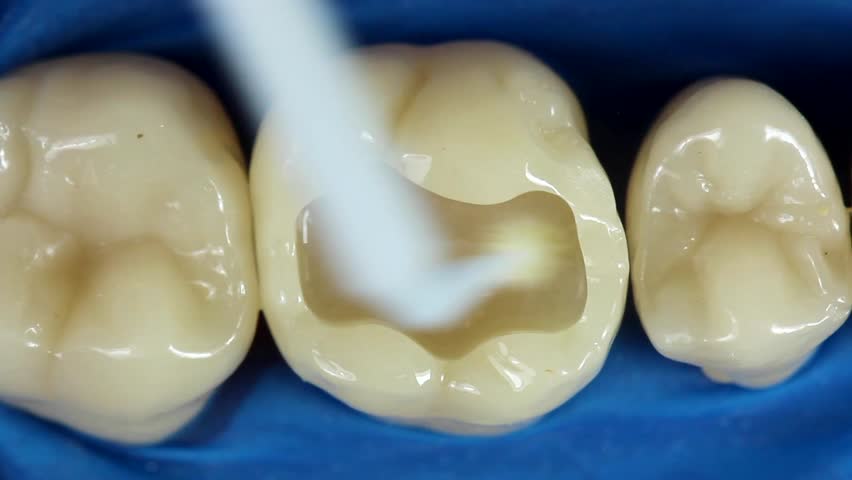 Как выглядят жевательные зубы фото Resin Stock Videos, Editorial Videos and Stock Footage Shutterstock